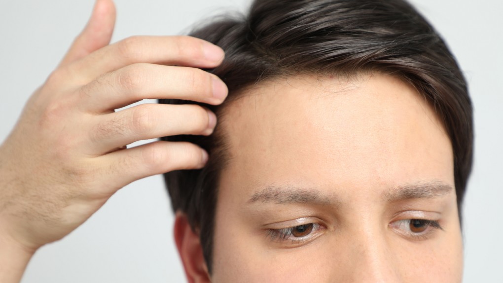 Два основных метода пересадки волос