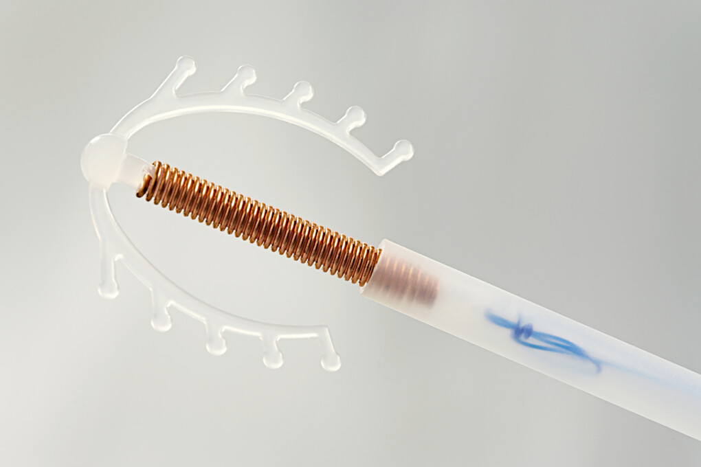 Spirala antykoncepcyjna. Co należy o niej wiedzieć przed założeniem?