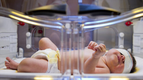 Żółtaczka u noworodków - żółtaczka fizjologiczna a żółtaczka patologiczna