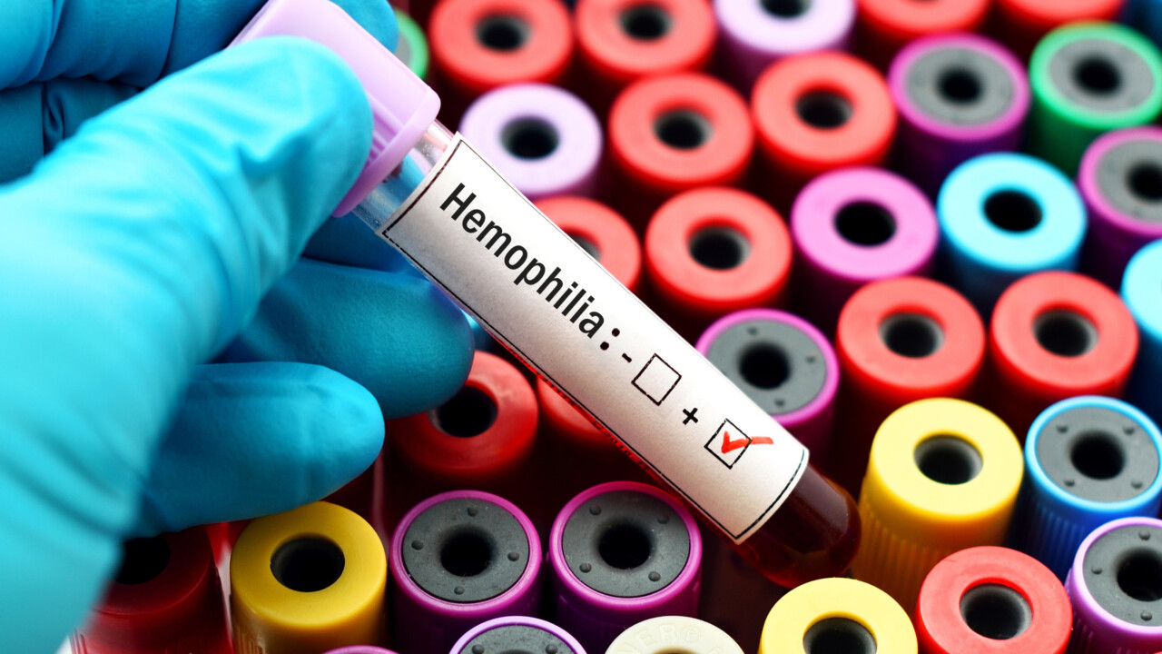 Hemofilia typu A, B, C - dziedziczenie, objawy, leczenie