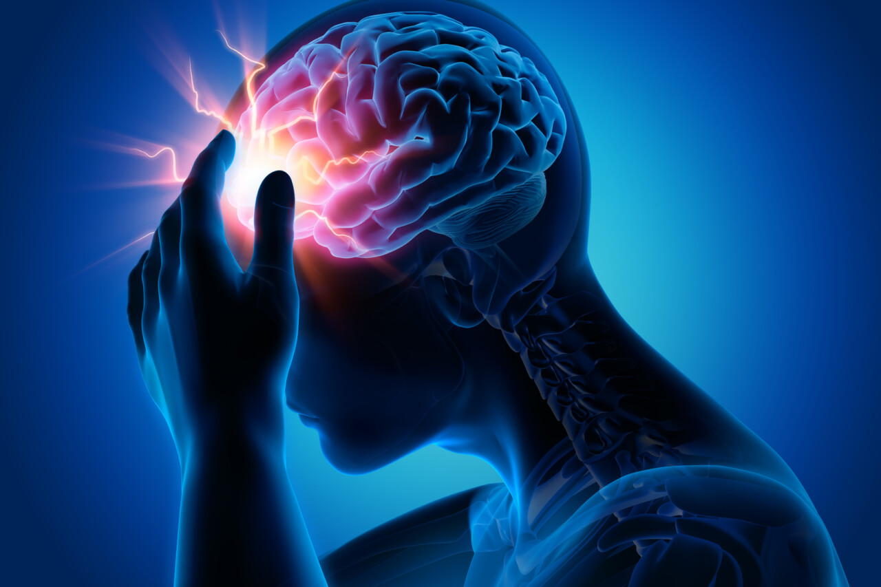 Migrena porażenna - przyczyny, objawy, leczenie 