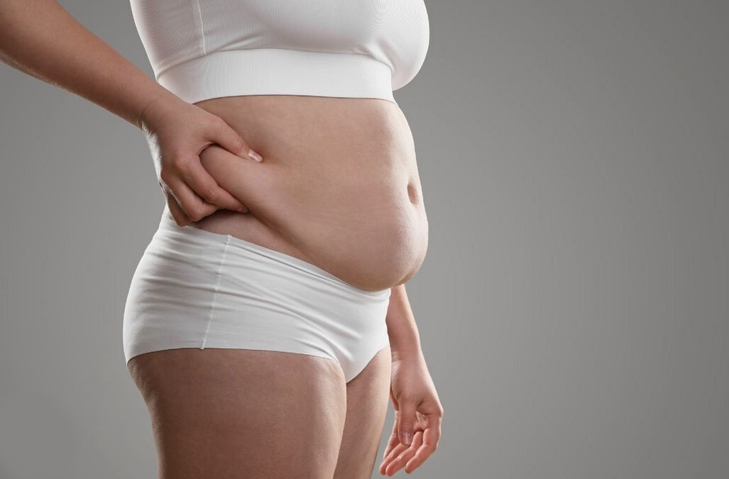 Abdominoplastyka. Zabieg, który może zmienić życie